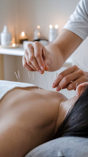 Acupuncture For Athletics