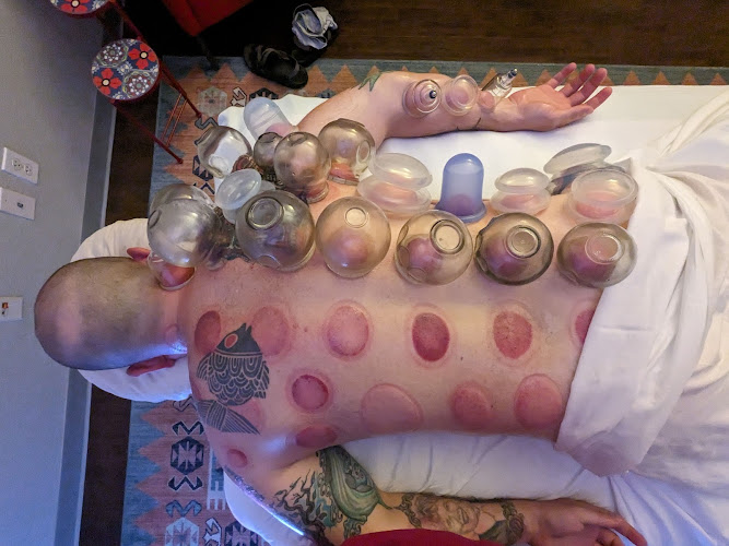 As You Are Acupuncture