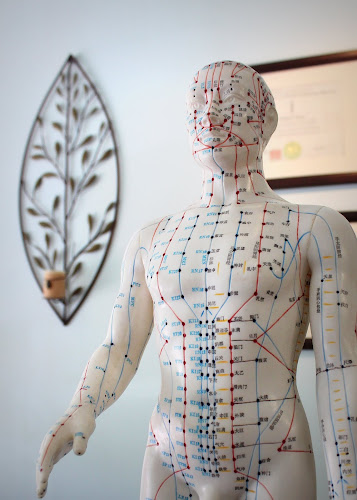 Berkeley Acupuncture