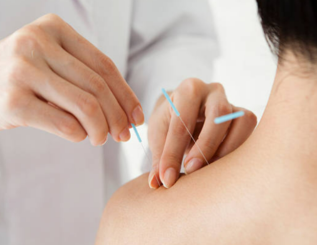 California Acupuncture & Chiropractic Center