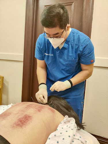 David Di Acupuncture