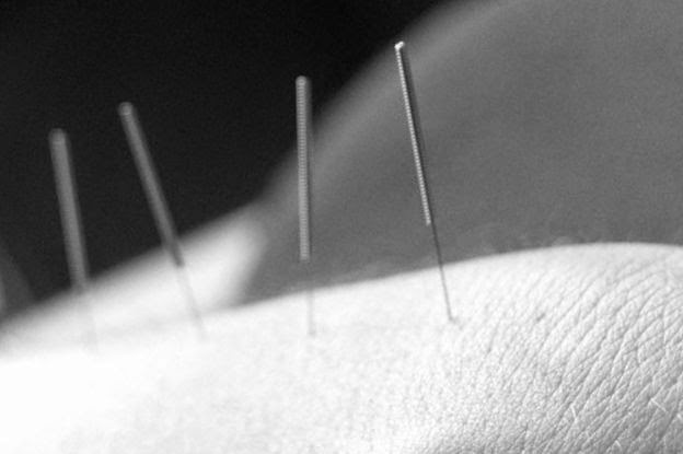 Earthspring Acupuncture, PLLC