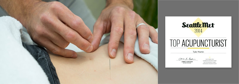 Fit Acupuncture