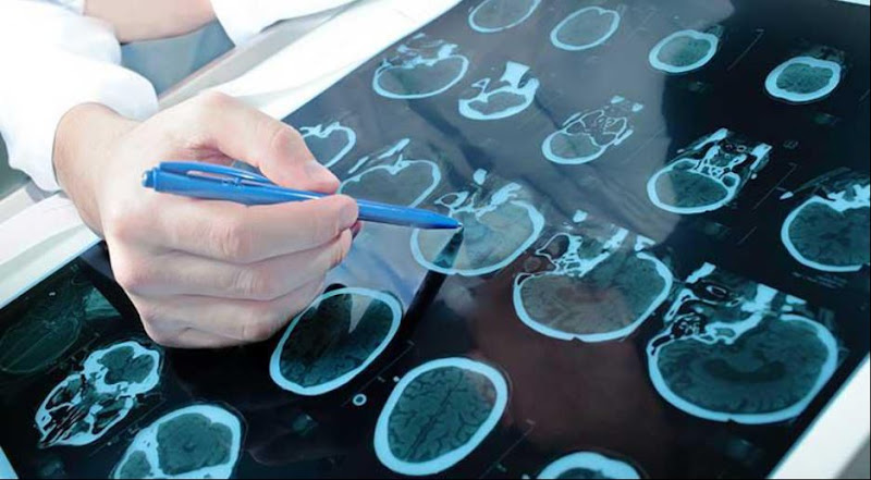 Neurological Institute of Los Angeles - East LA