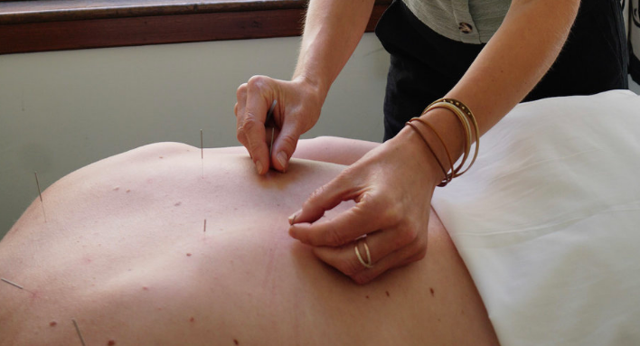 PDX Acupuncture at La Shala Well