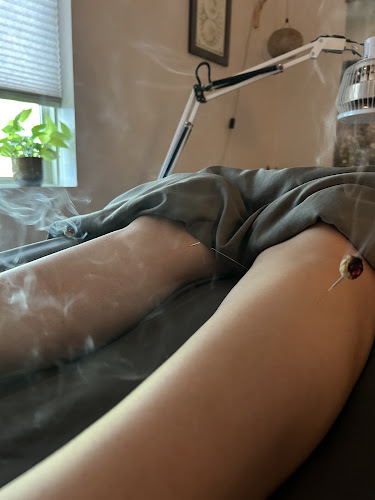 Radiant Acupuncture PLLC